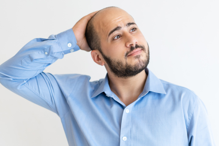 https://staging.healthychoicenepal.com/wp-content/uploads/2023/04/balding.jpg