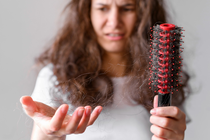 https://staging.healthychoicenepal.com/wp-content/uploads/2023/04/hairloss.jpg