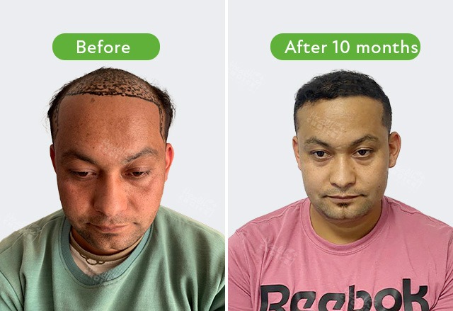 https://staging.healthychoicenepal.com/wp-content/uploads/2024/01/7d700f6f-a191-4900-a7c2-15e239298a47.jpg