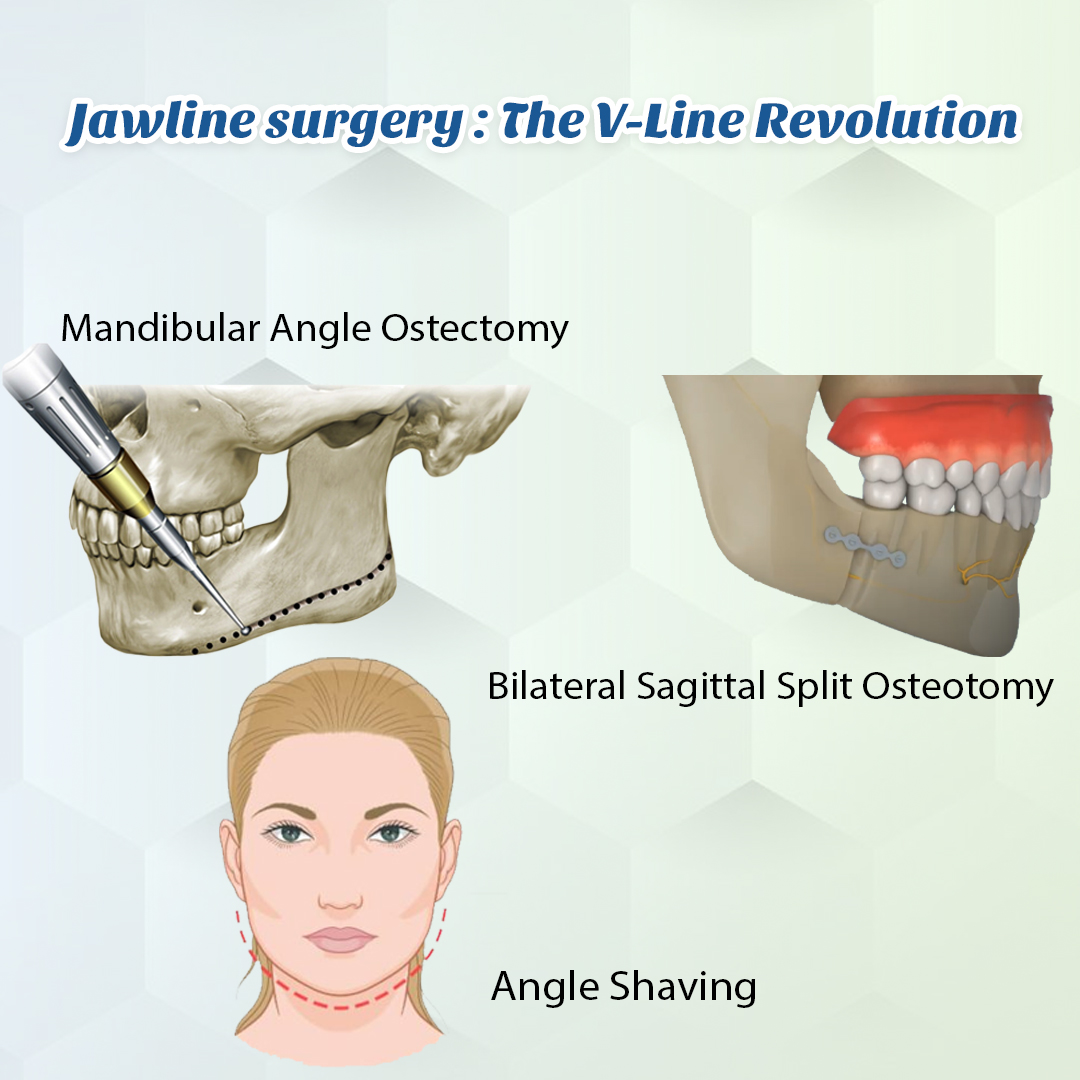 https://staging.healthychoicenepal.com/wp-content/uploads/2025/01/Jawline-copy-2.jpg
