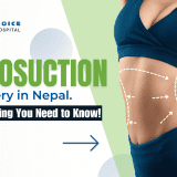 Liposuction Surgery In Nepal: Everything You Need to Know!
