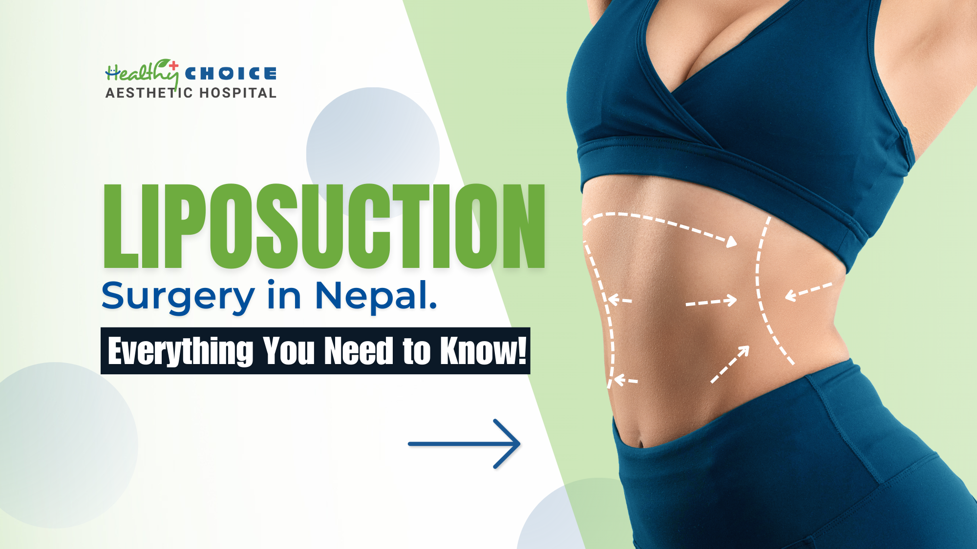 Liposuction Surgery In Nepal: Everything You Need to Know!