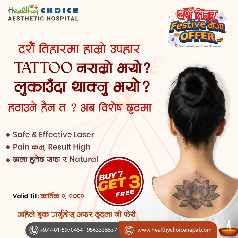 tattoo removal packages with festive discounts