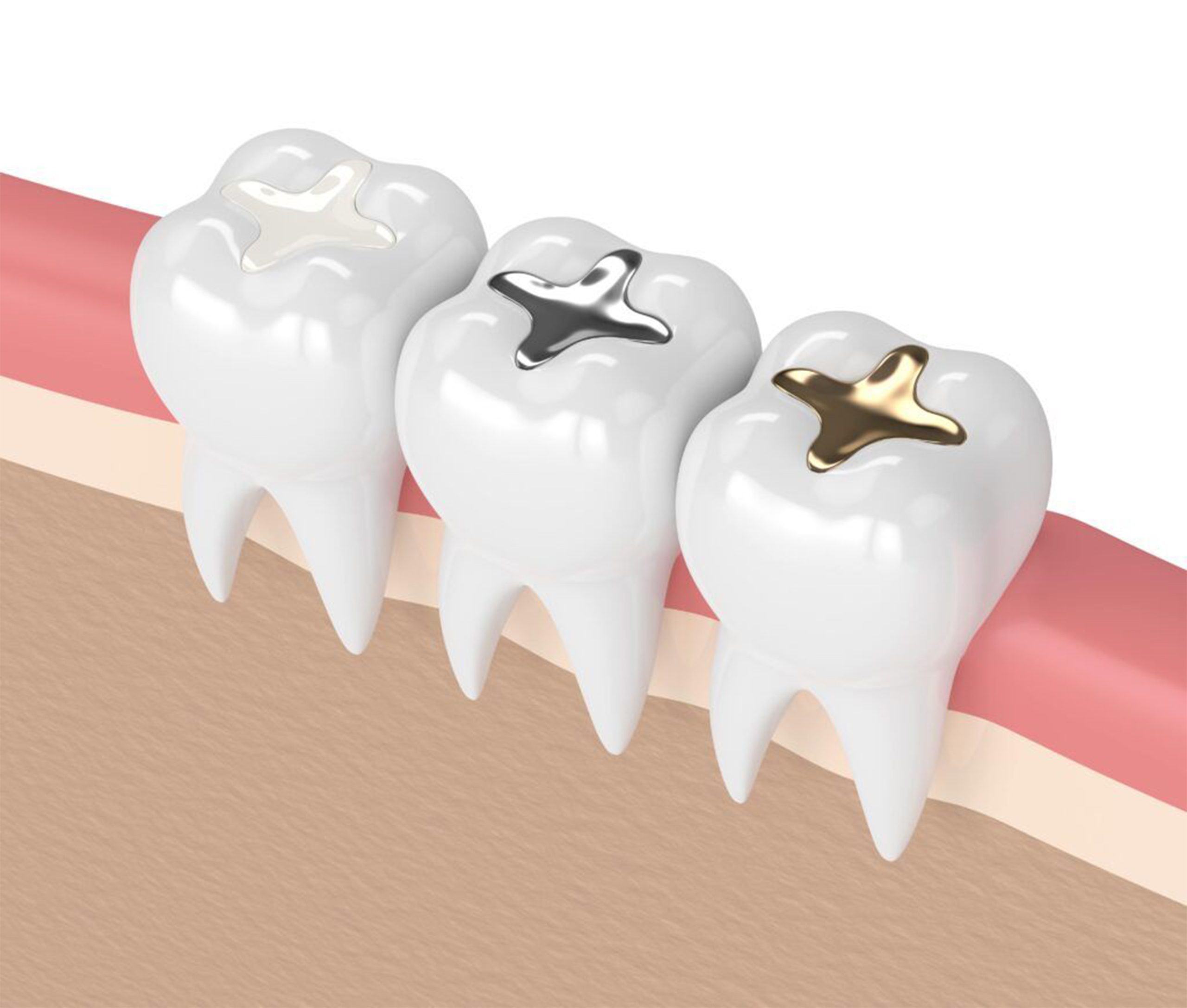 https://staging.healthychoicenepal.com/wp-content/uploads/2025/11/Denta-filling-copy-1-scaled.jpg